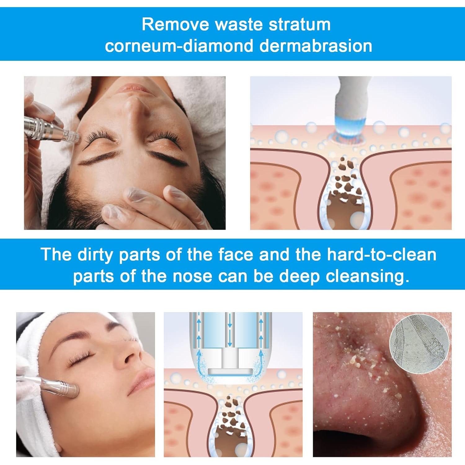 Máquina de Microdermoabrasi&oacute;n de Diamante AIMENGXI - Portátil, 9 Puntas, Eliminación de Puntos Negros