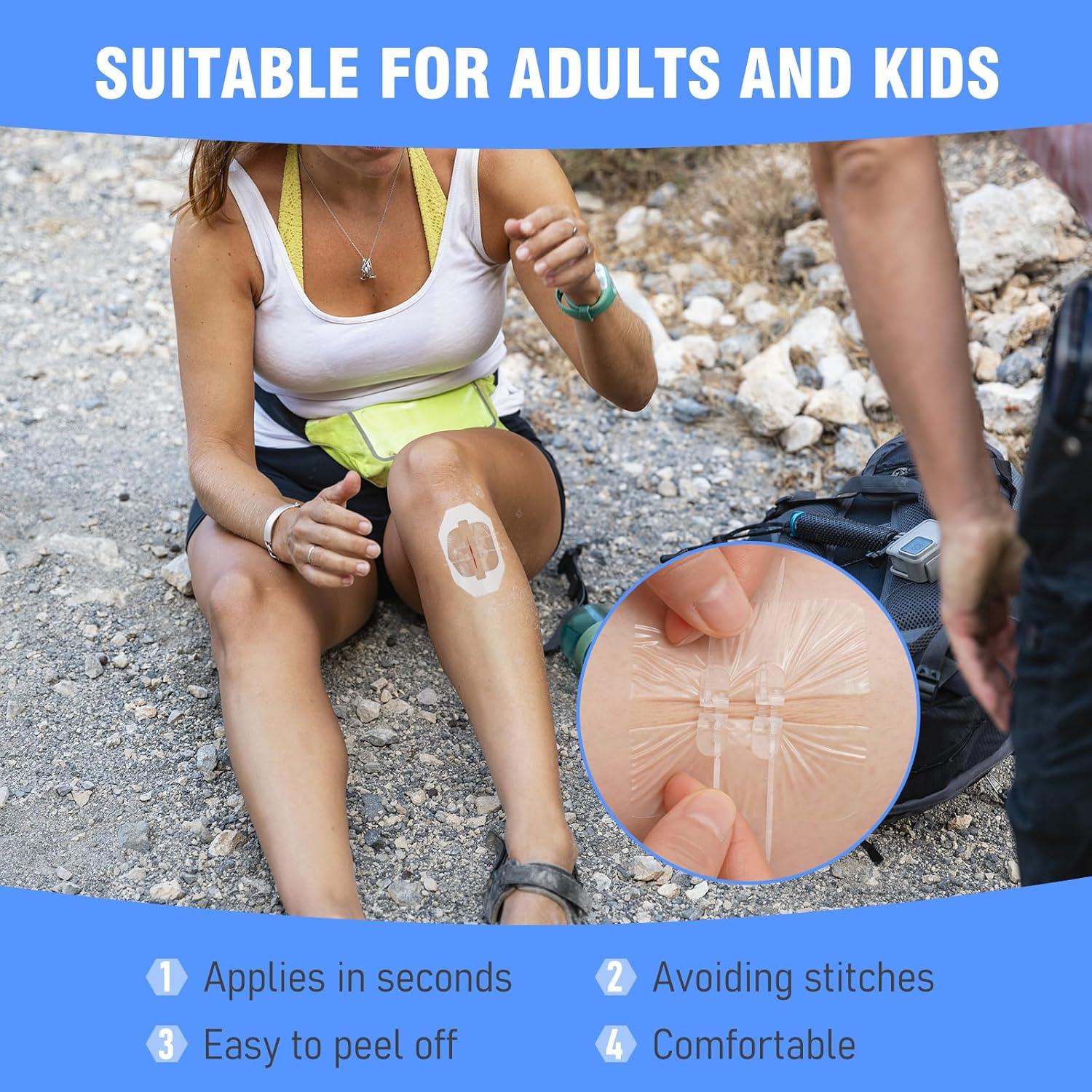 Kit de Cierre de Heridas AUSLKA - 4 Tiras Mariposa 6.99 cm