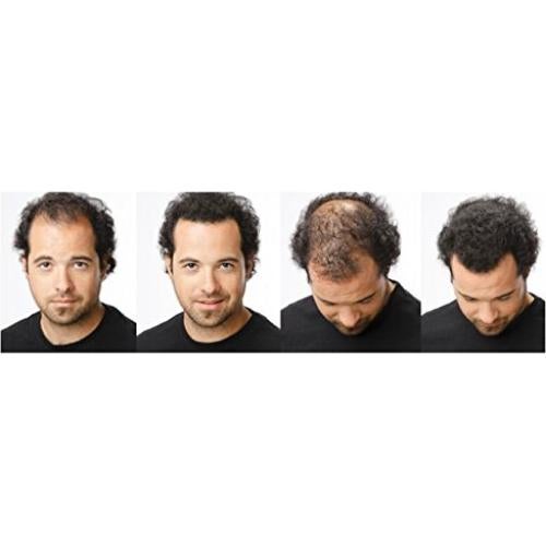 Fibras para Cabello Ustar Castaño Rojizo 27.5g - Calidad Toppik