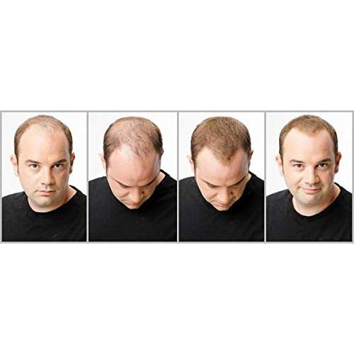 Fibras para Cabello Ustar Castaño Rojizo 27.5g - Calidad Toppik