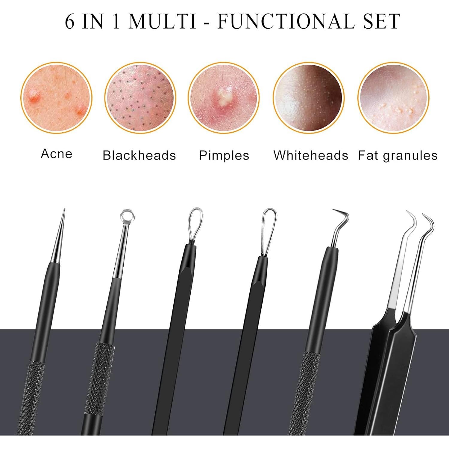 Kit de Herramientas para Espinillas Boxoyx - 6 Piezas Acero Inoxidable