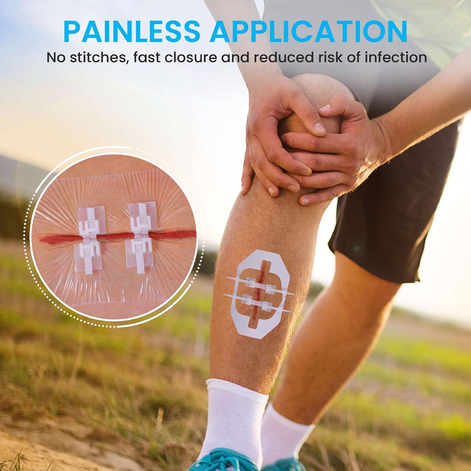 Tiras de Cierre de Heridas Antaly - Kit 4 Paquete Transpirables