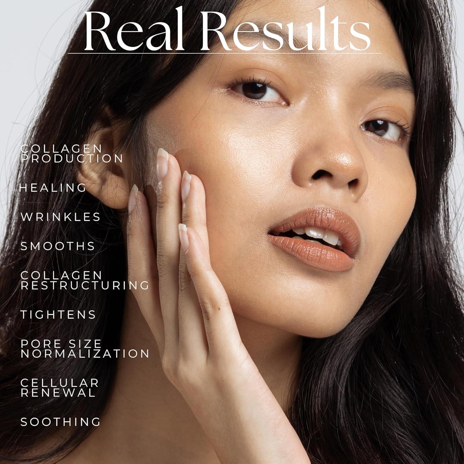 Bombilla de Infrarrojo Cercano RubyLux NIR-A 250W - Terapia