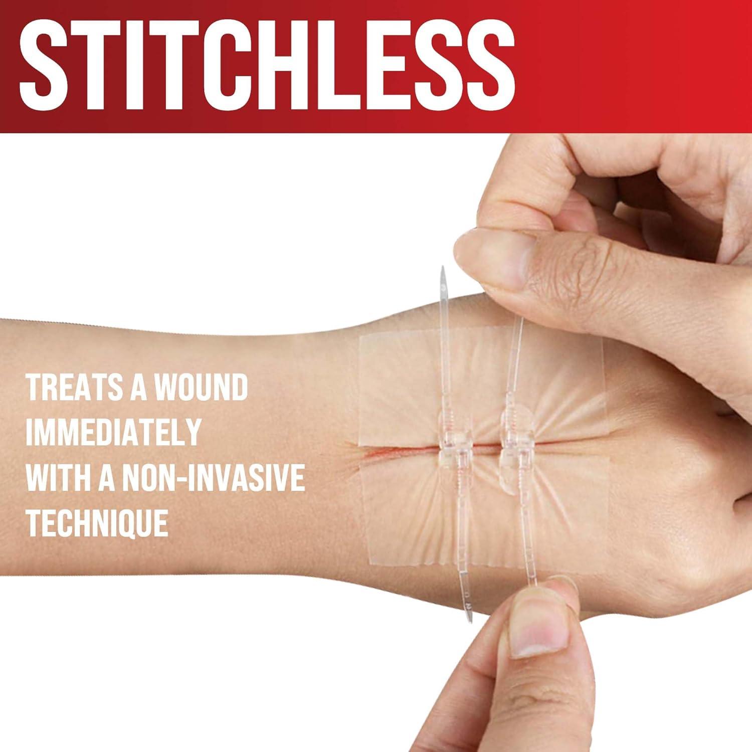 Kit de Cierre de Heridas MyHelp - Vendaje Mariposa 2 Tiras