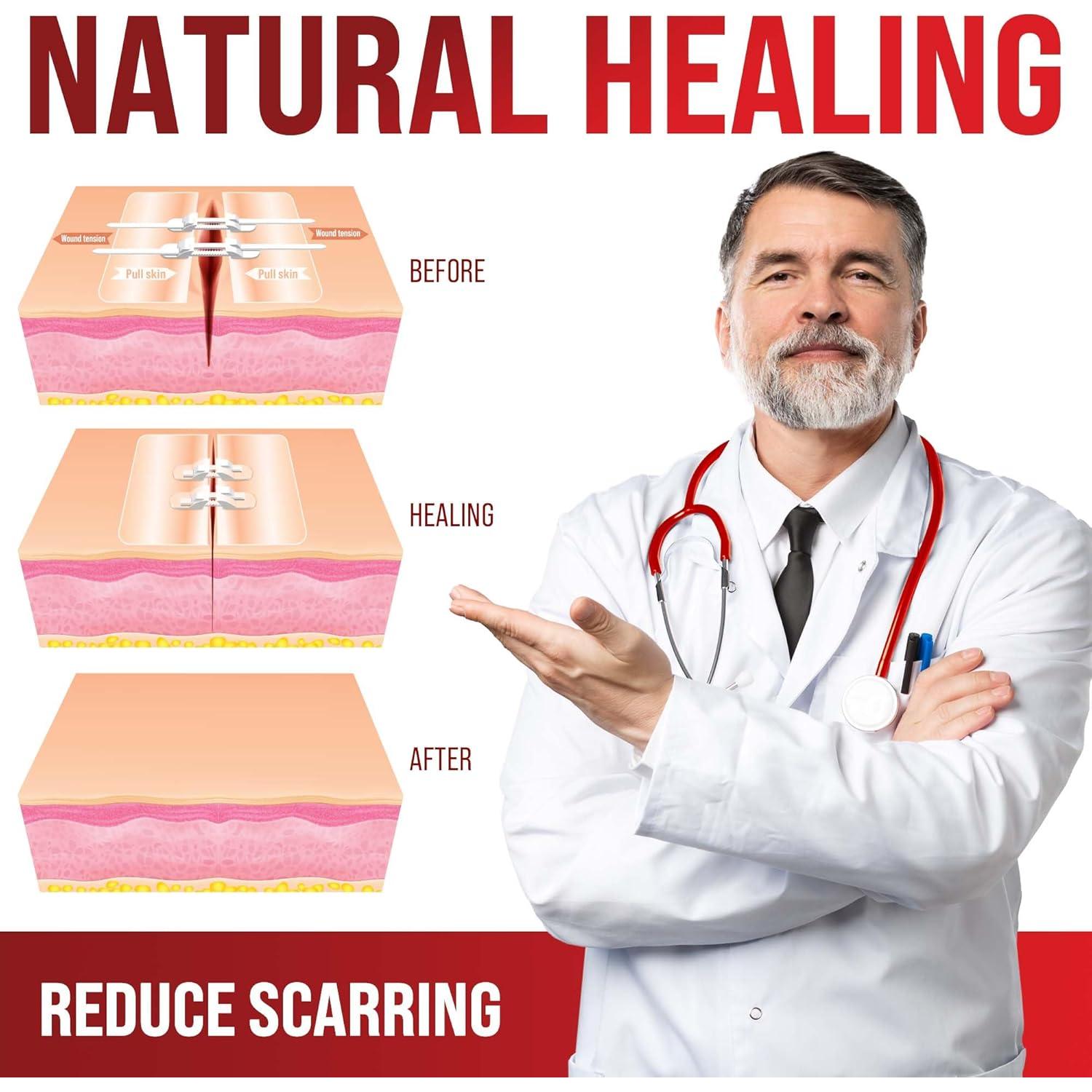 Kit de Cierre de Heridas MyHelp - Vendaje Mariposa 2 Tiras