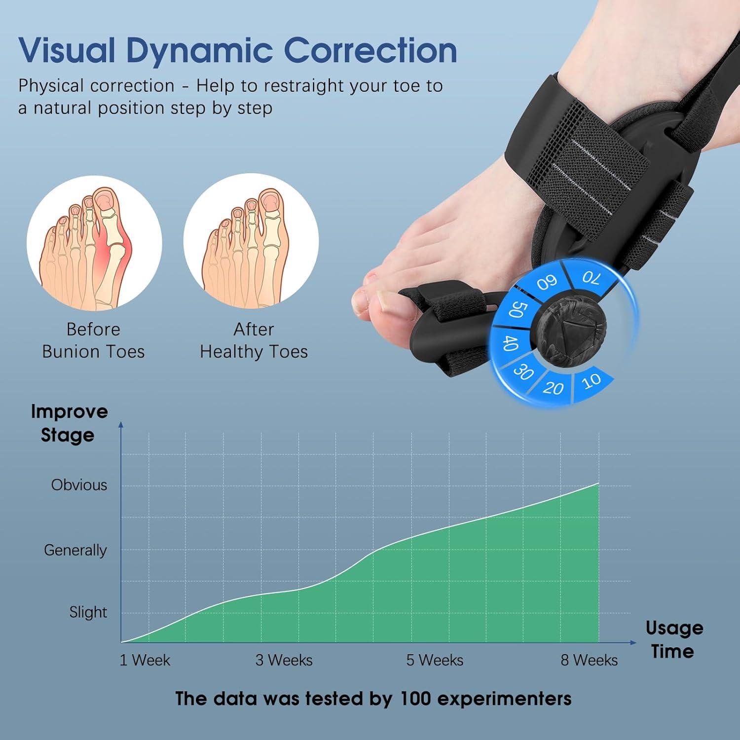 Corrector de Juanetes KASHEVI Ajustable para Alivio del Dolor