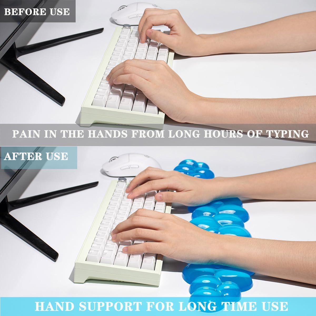 Conjunto Reposamuñecas Gel Silicona Ergonómico Azul - 2 Piezas