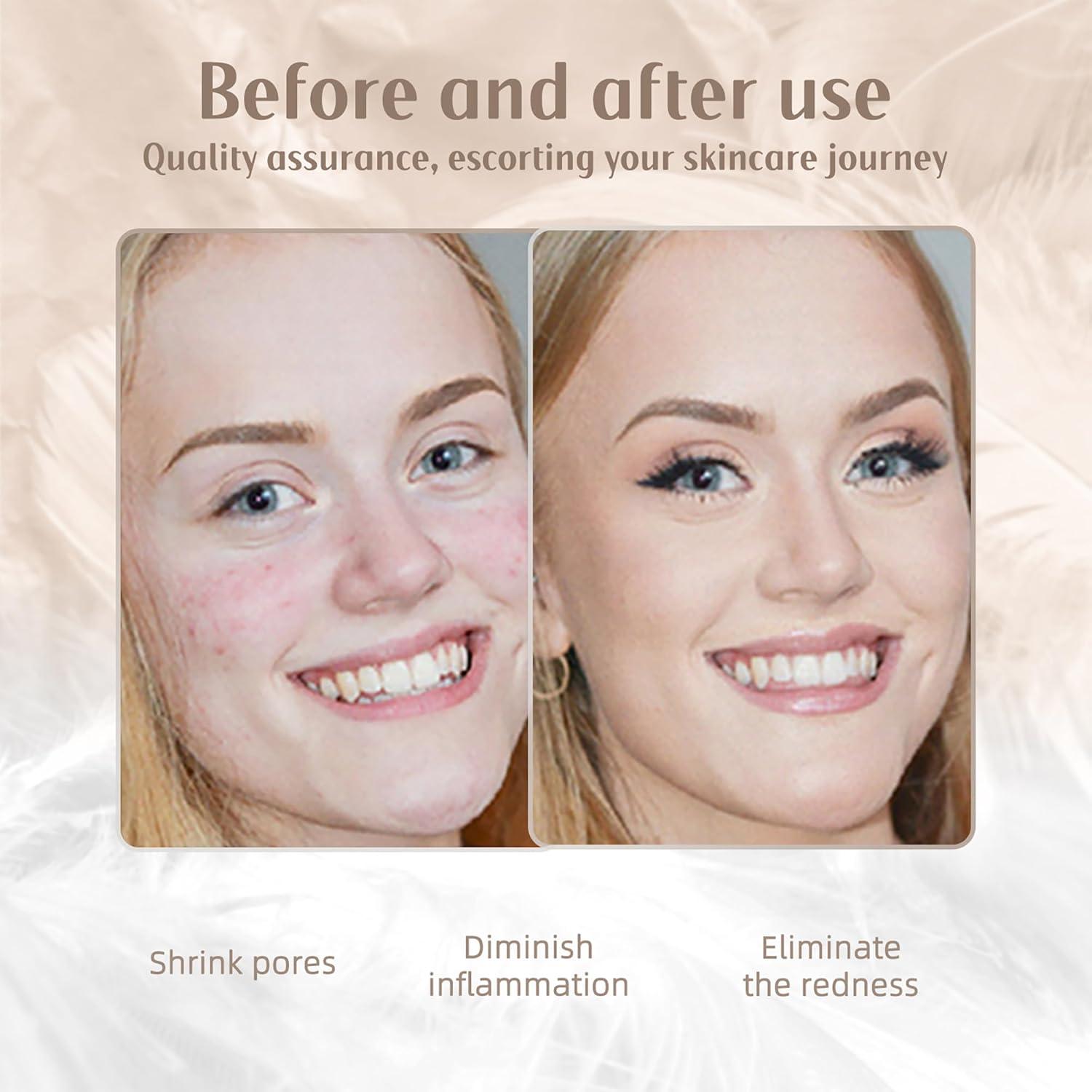 Varita de Terapia de Luz Roja LED Facial Shenzhen Yixin 7 Colores