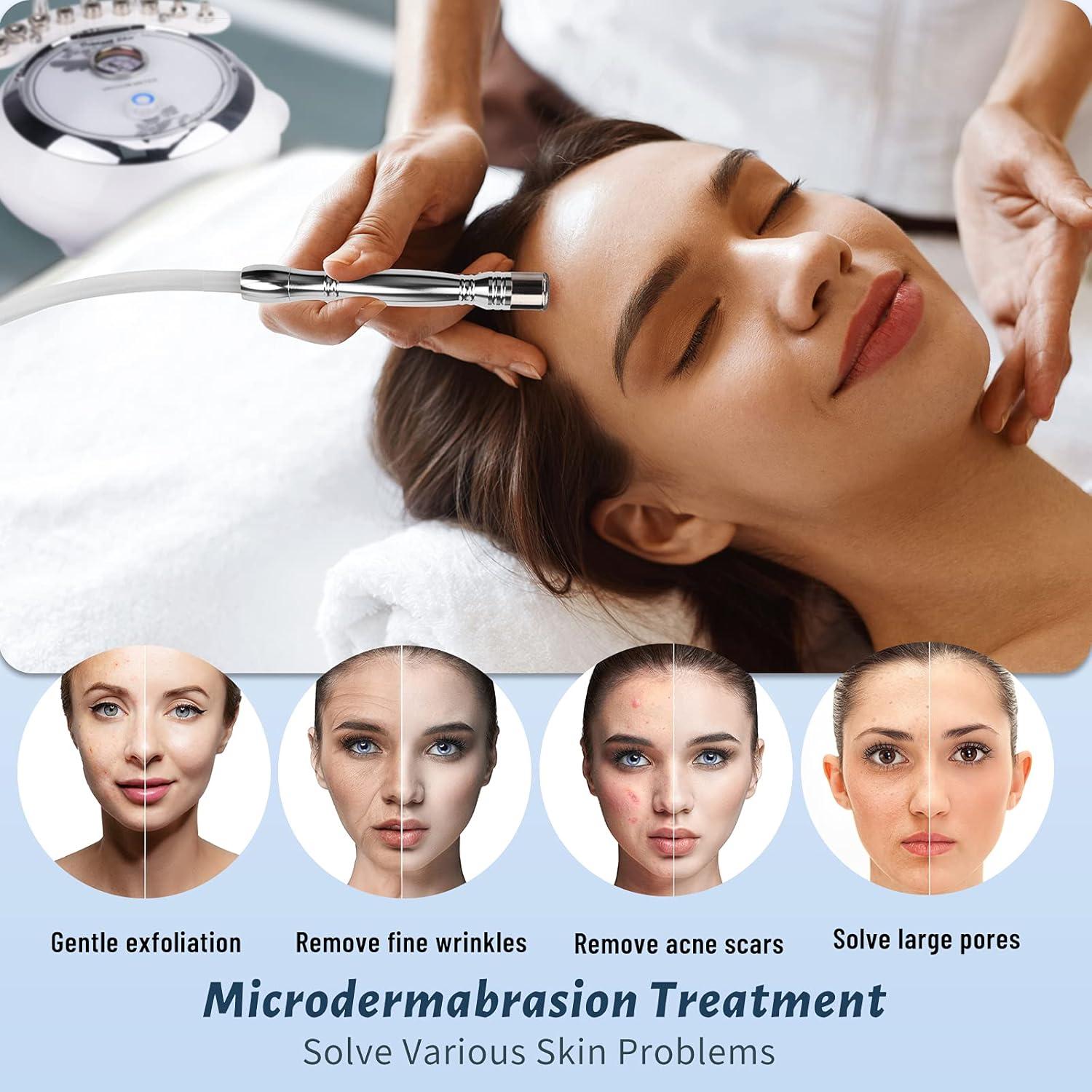 Máquina de Microdermoabrasión Yofuly 3 en 1 65-68 cmHg