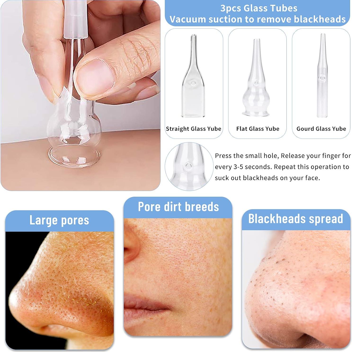 Máquina de Microdermoabrasión Yofuly 3 en 1 65-68 cmHg