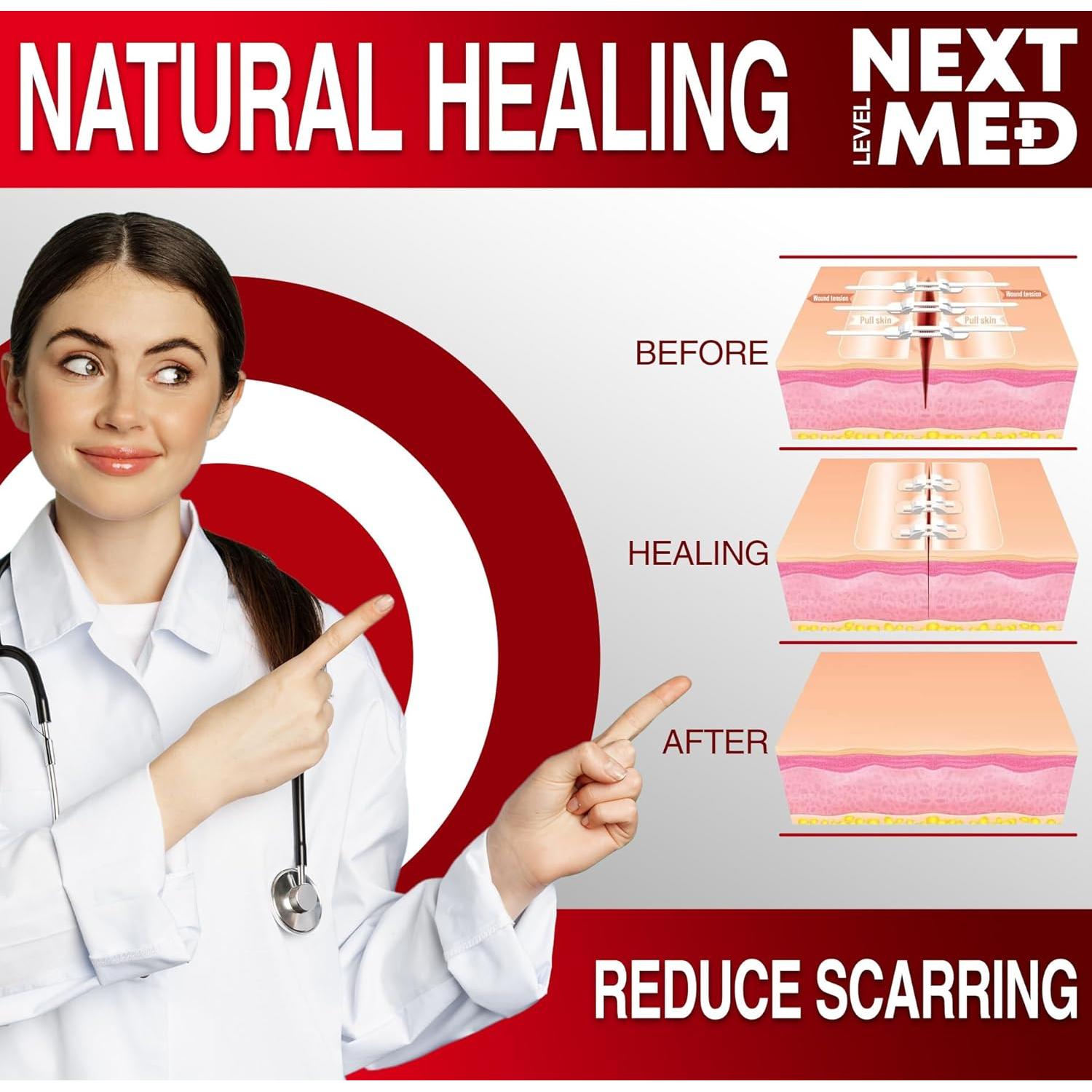 Kit de Cierre de Heridas Next Level Med - 3 Steri Stitch y 4 Zip Stitch