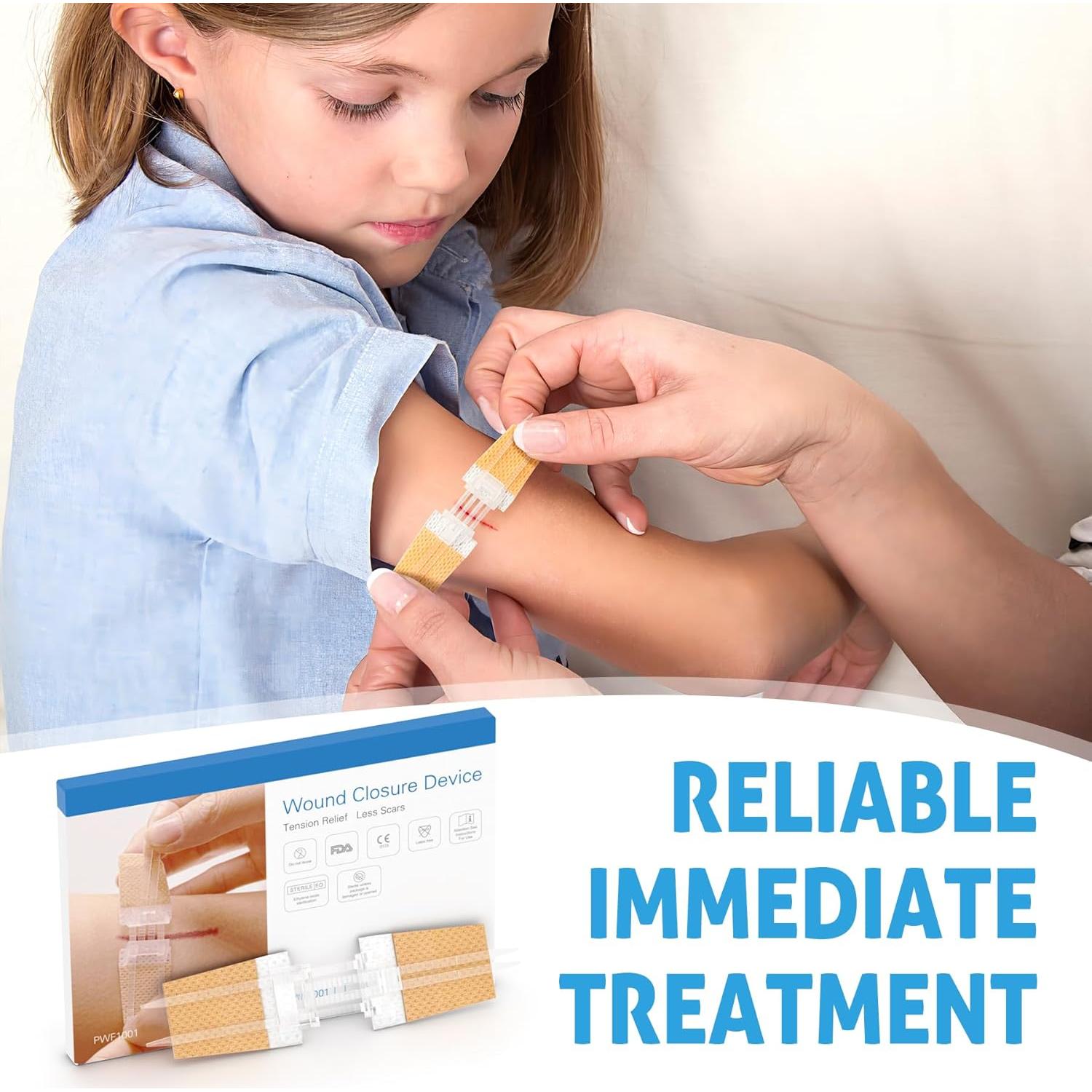 Kit de Cierre de Heridas Sin Suturas SEABIRD - 2 Piezas