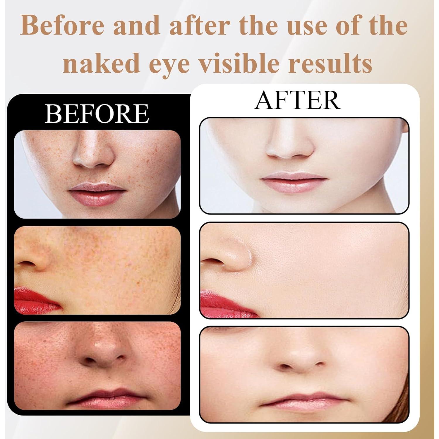 Red Light Therapy For Face,Led Face Mask Light Therapy, 7 Color Red Light Therapy Mask, Rechargeable,Portable,Household Led Face Mask (Black)