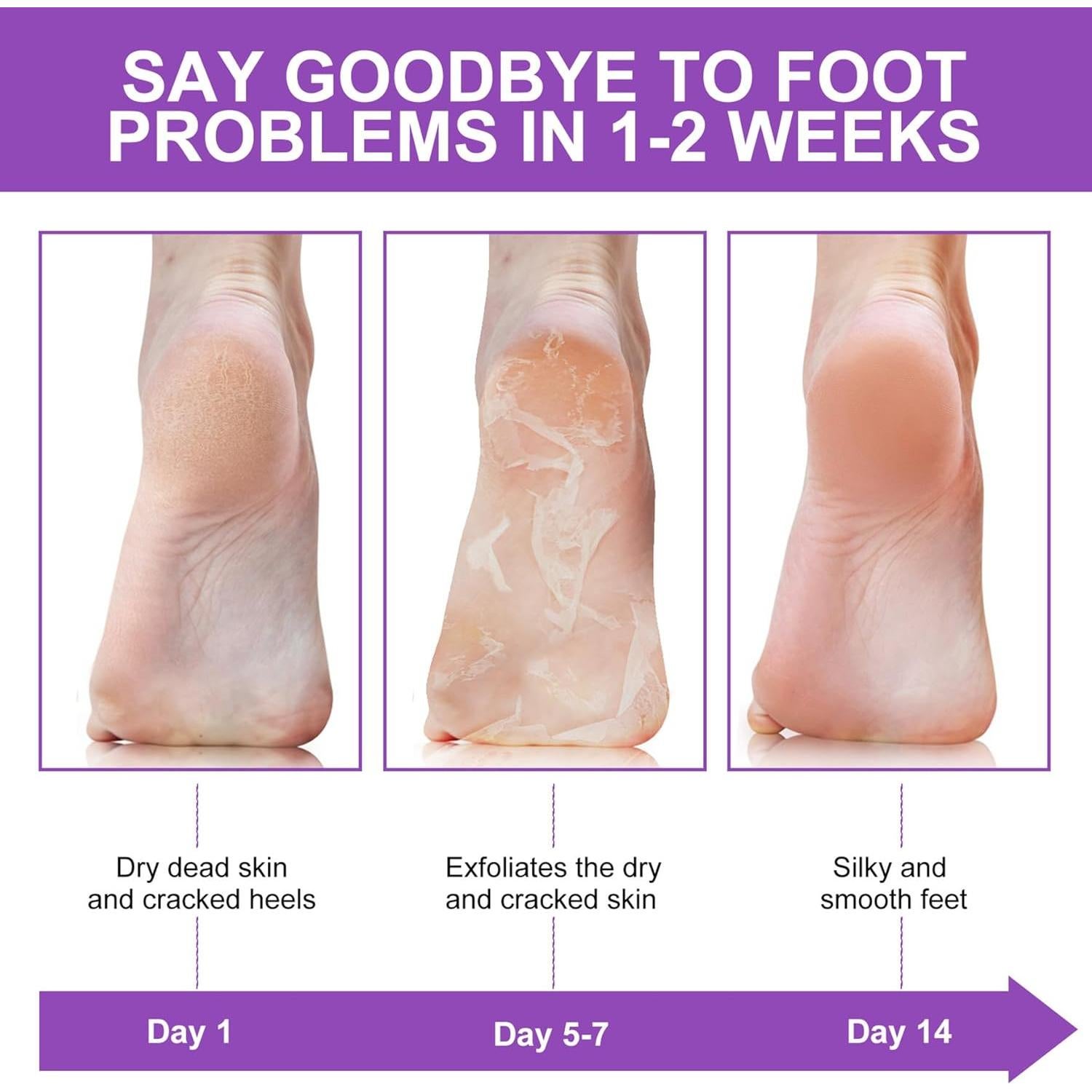 Mascarilla Exfoliante para Pies ALIVER 3 Paquetes Lavanda