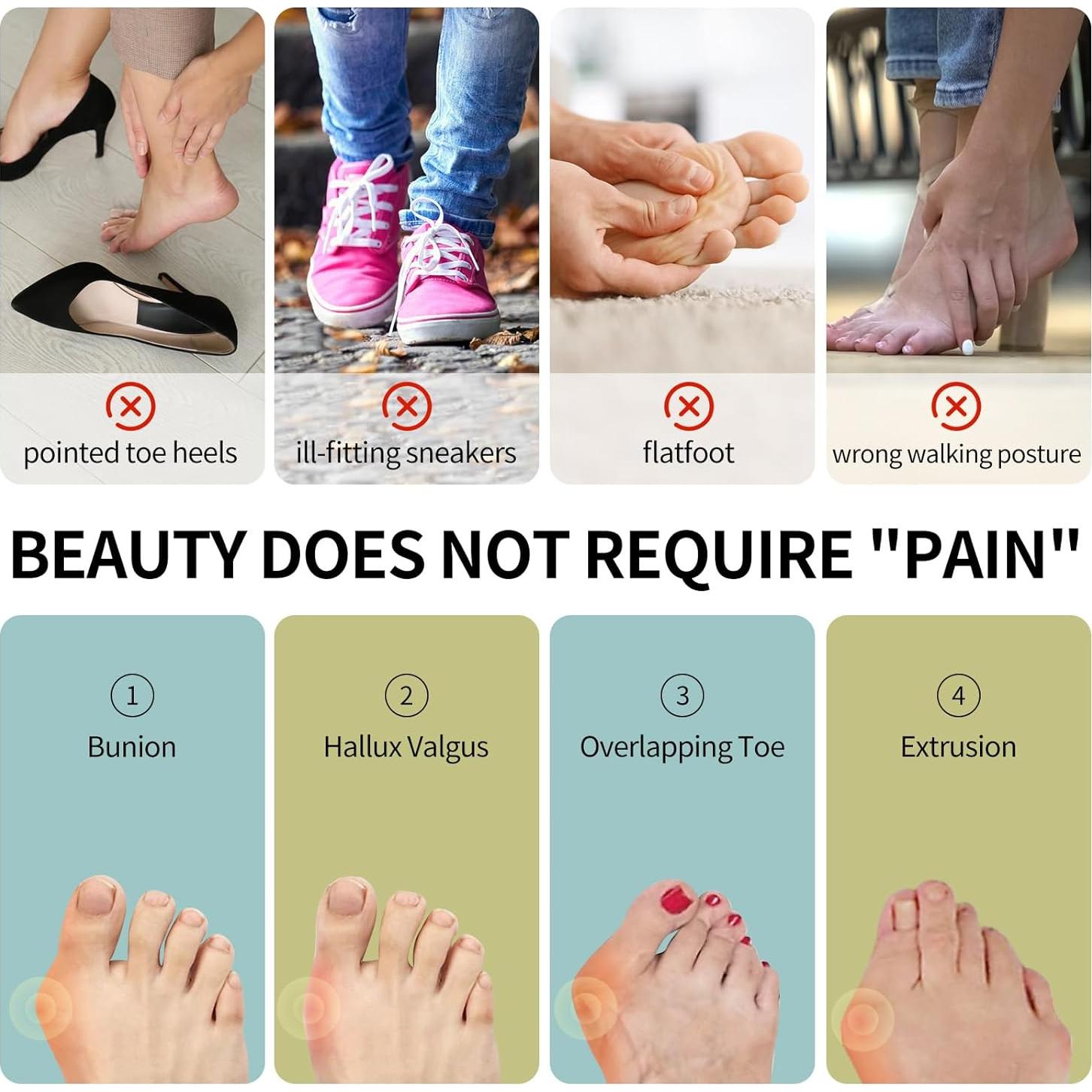 Corrector de Juanetes Ajustable Erouevnket 1 Set Alivio Dedo Gordo