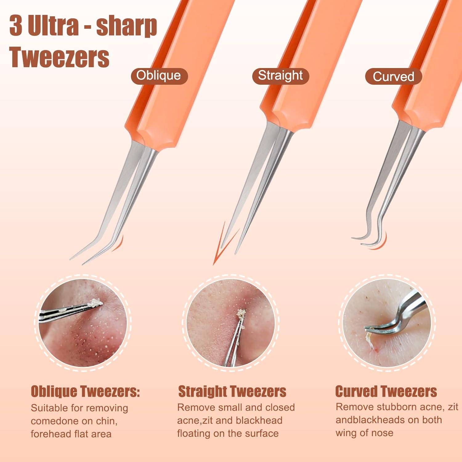 Kit de Herramientas para Eliminar Granos MORGLES 15 Pcs Acero Inoxidable