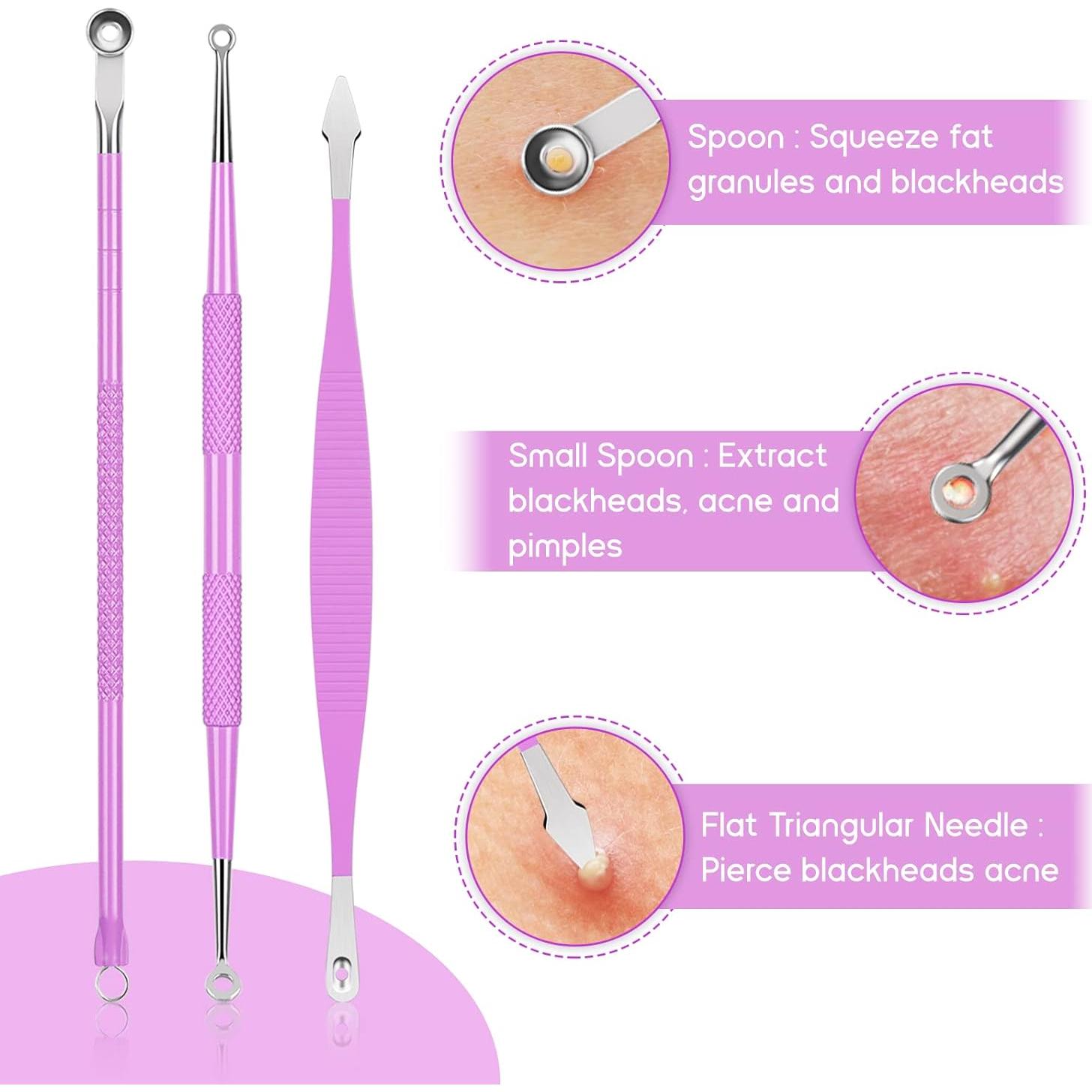 Kit de Herramientas para Eliminar Granos MORGLES 15 Pcs Acero Inoxidable