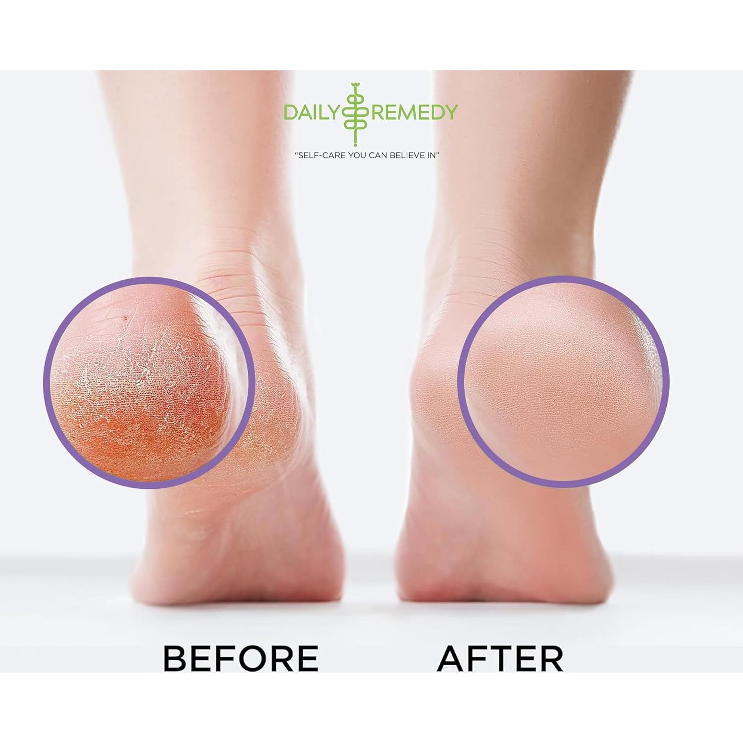 Remojo de Pies Daily Remedy 453.6 g con Sal de Epsom y Lavanda