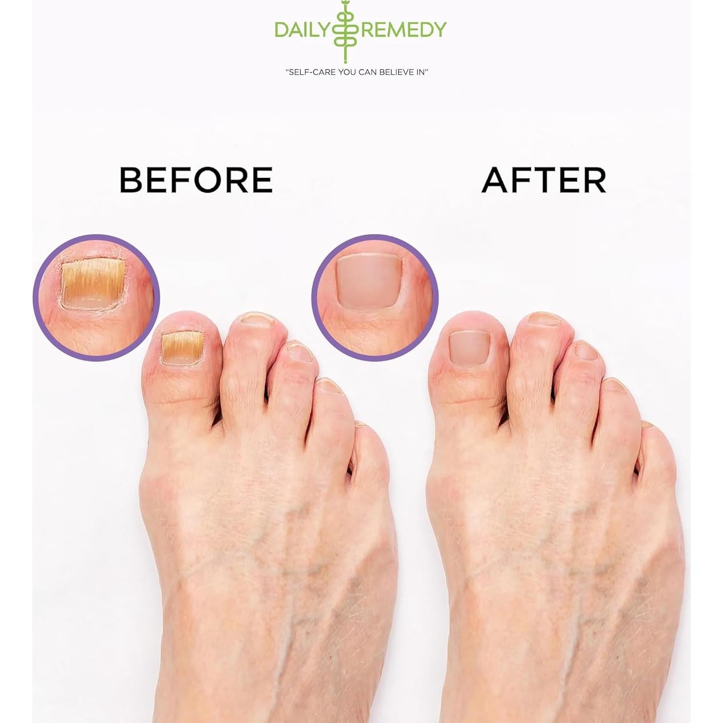 Remojo de Pies Daily Remedy 453.6 g con Sal de Epsom y Lavanda