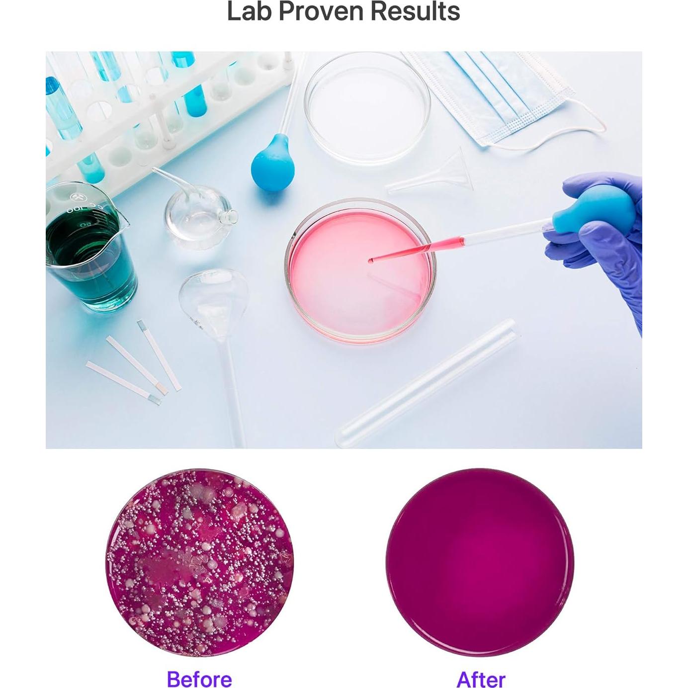 Varita desinfectante UV Knizen X5, portátil y recargable