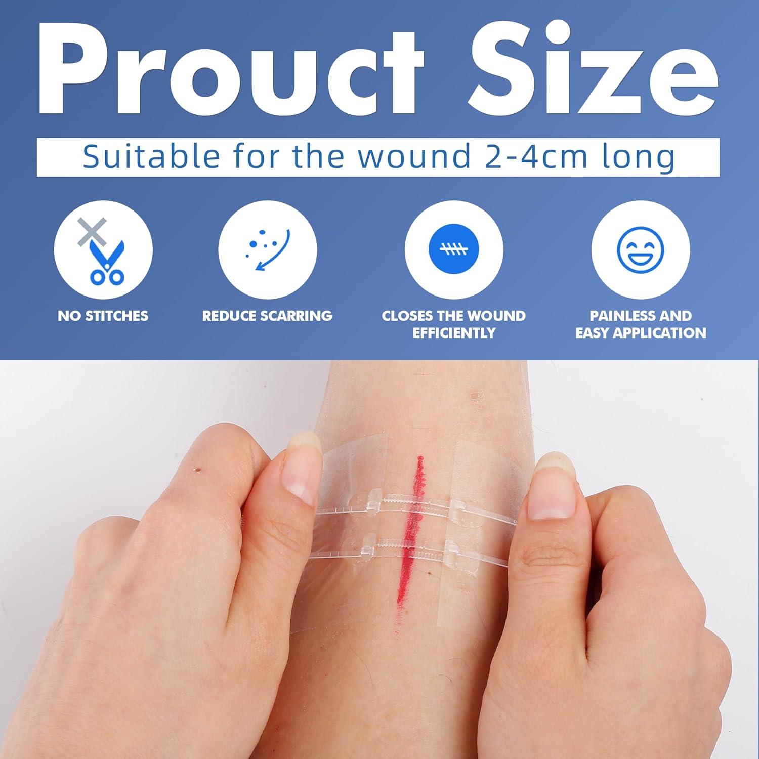 Cierres de Laceración de Emergencia 2 Pcs - Curitas Mariposa