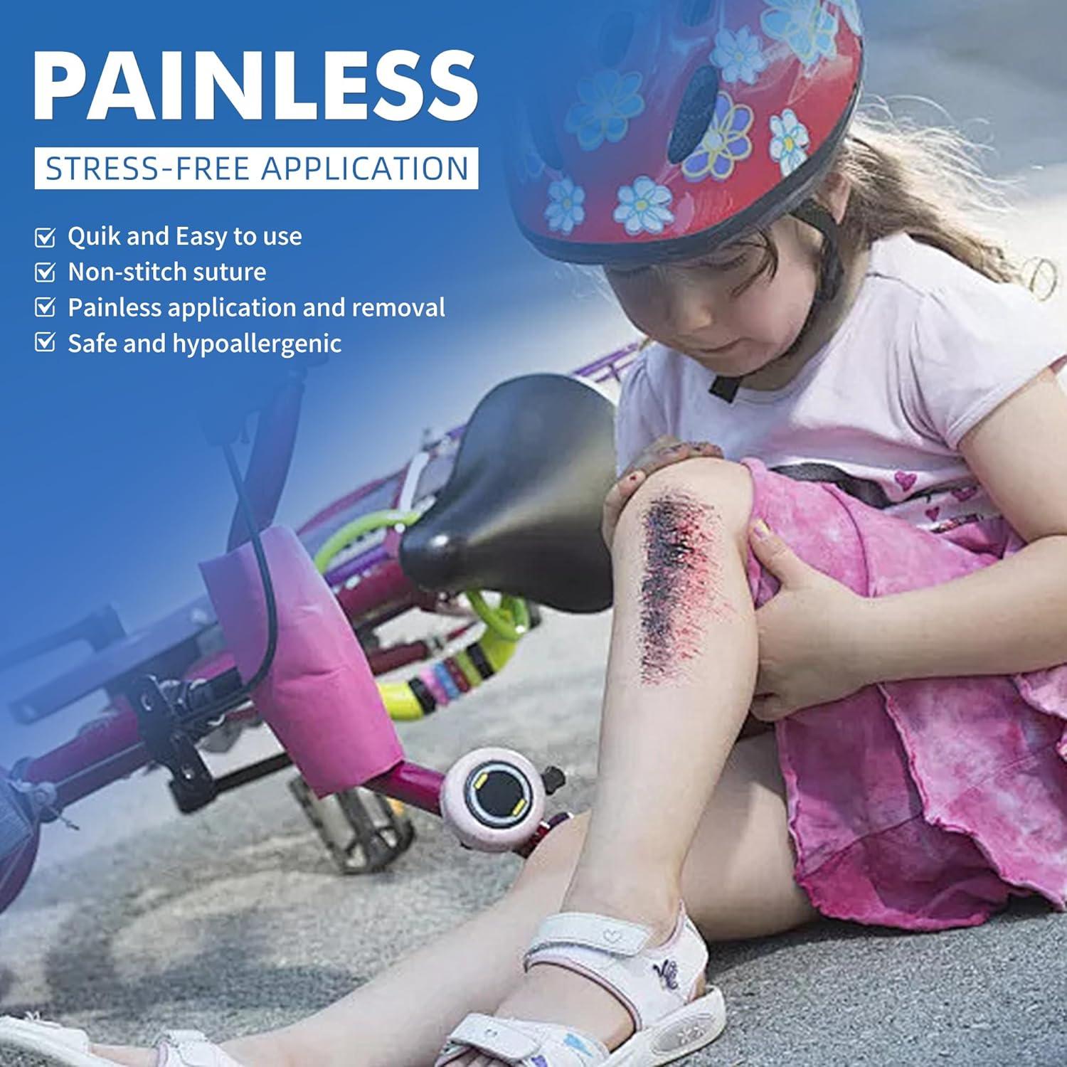 Cierres de Laceración de Emergencia 2 Pcs - Curitas Mariposa