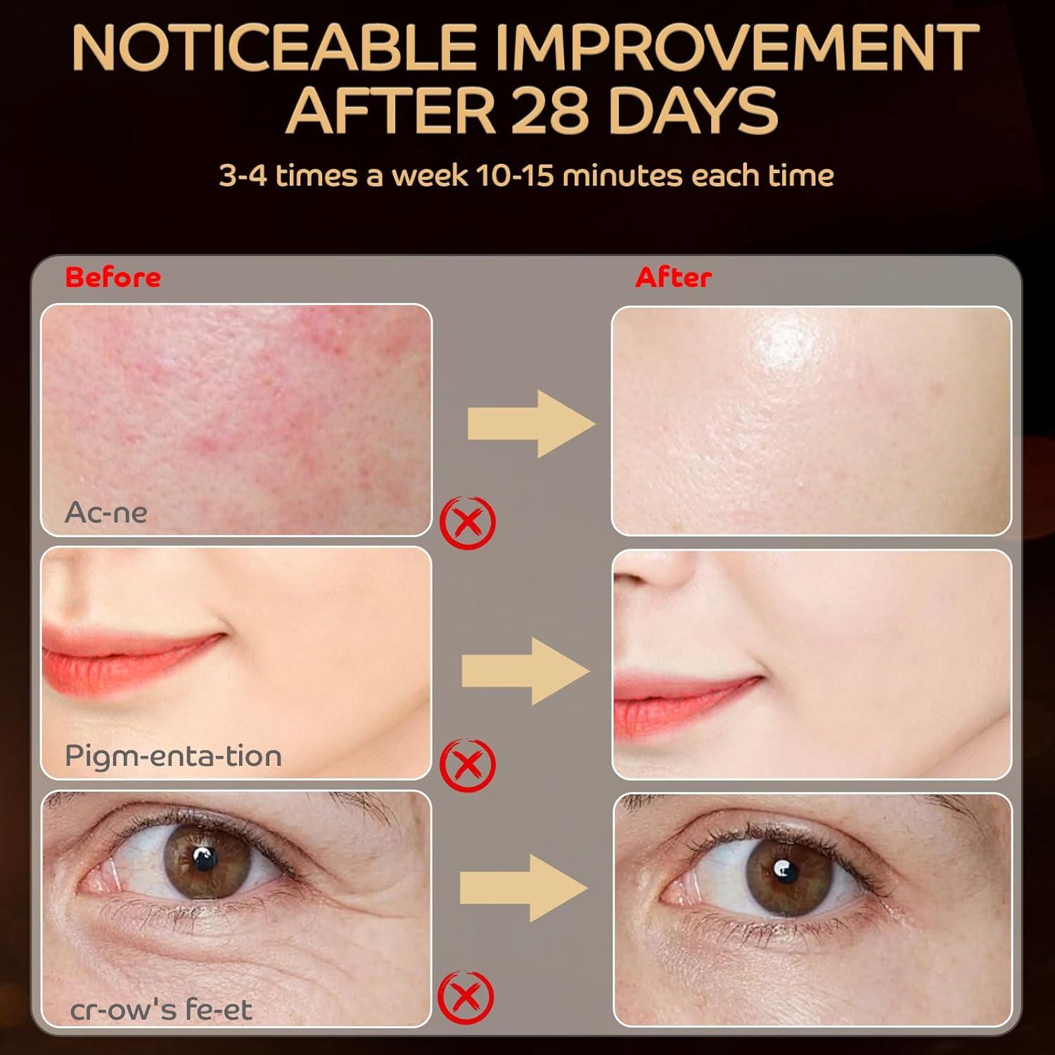 Máscara de Terapia de Luz Roja LED Hottoerak 660nm 850nm