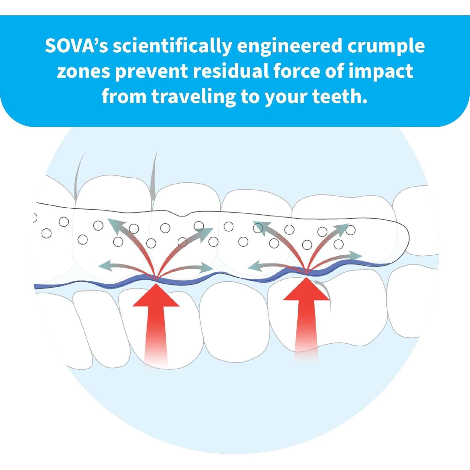 Protector Nocturno SOVA Aero - 1.6mm Ajuste Personalizado