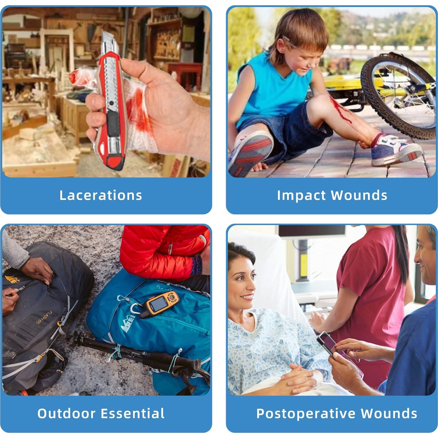 Cierres de Laceración de Emergencia LotFancy - 4 Unidades Estériles