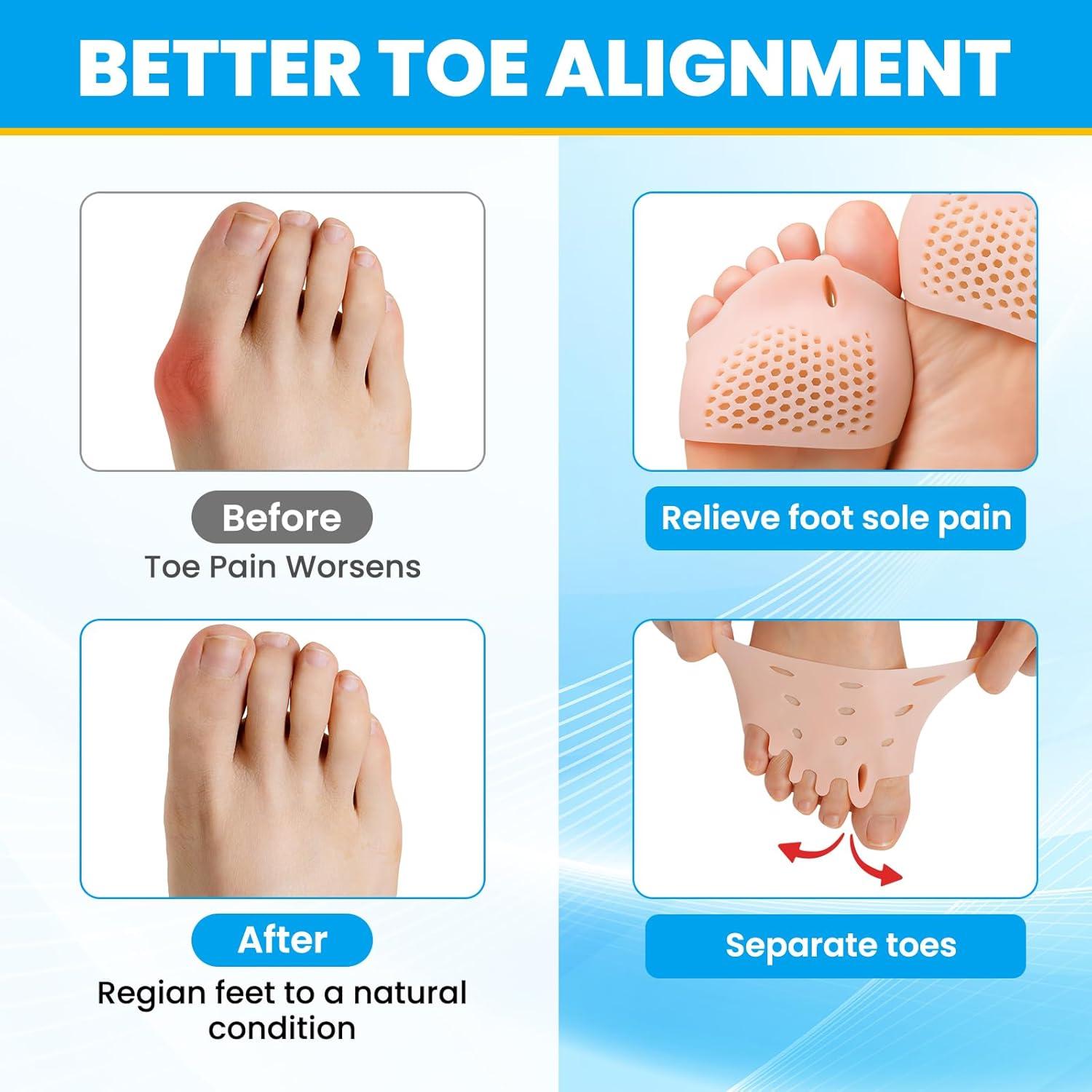 Almohadillas Metatarsales de Gel Pnrskter - 4 Pcs Nude