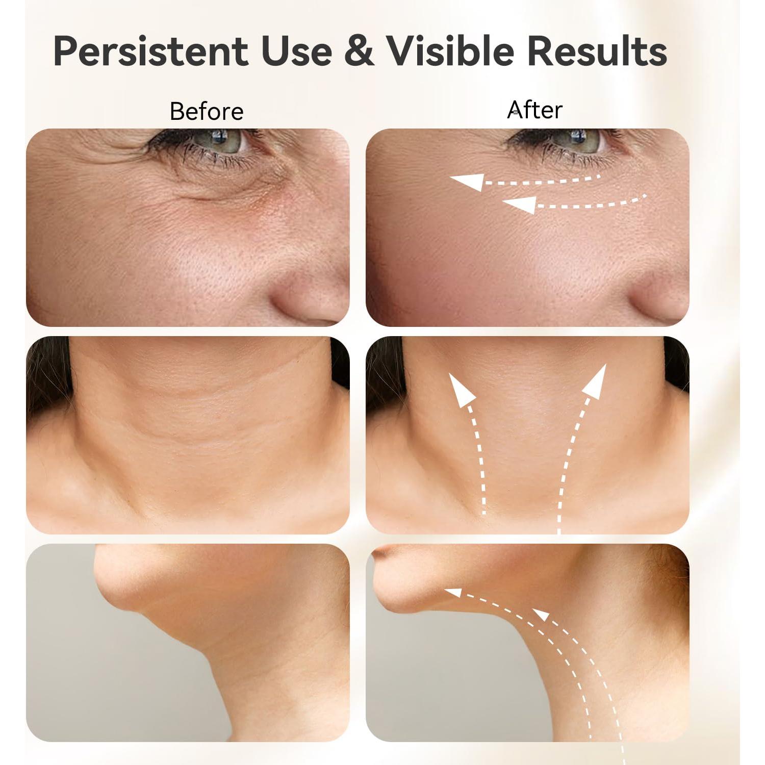 Masajeador Facial Gequip Portátil 3 Modos Cuidado Piel Blanco