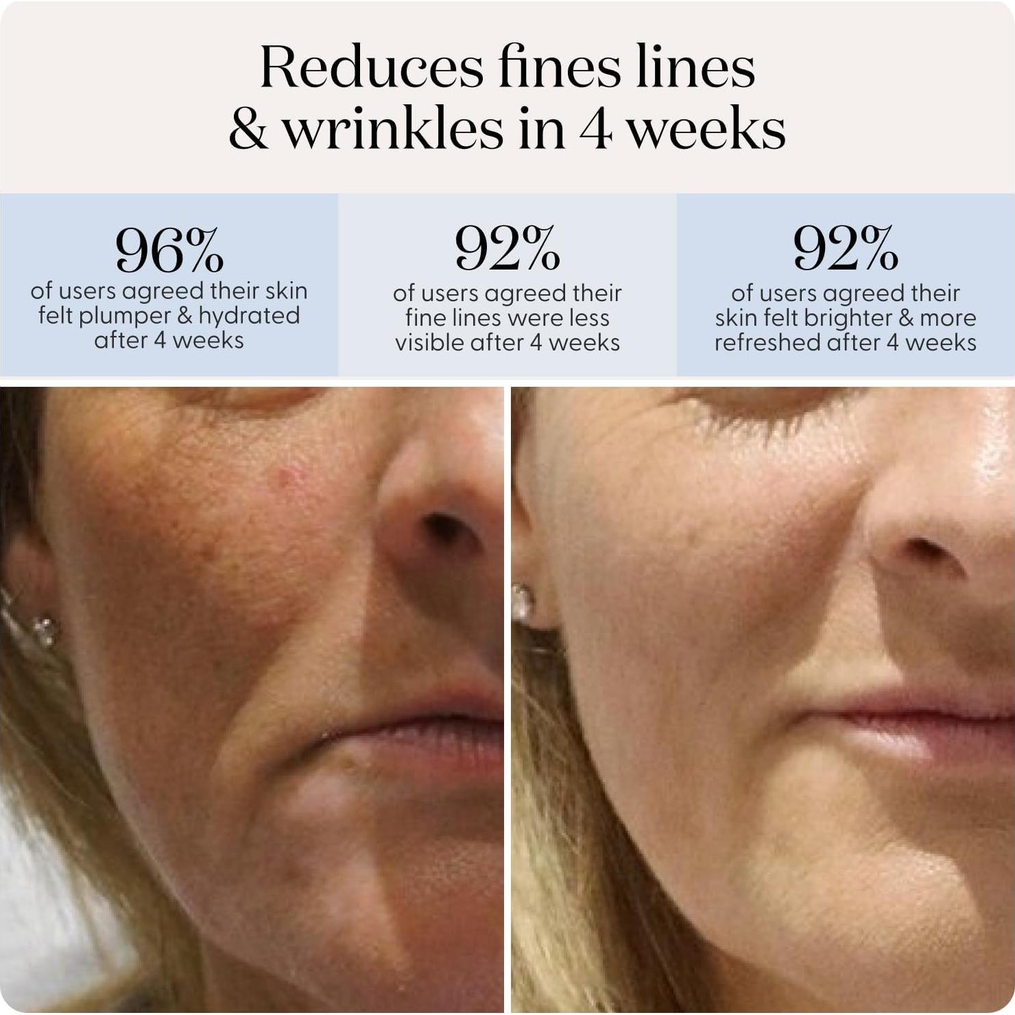 Máscara LED SmoothSkin DuoLux Terapia de Luz Roja 112 LEDs