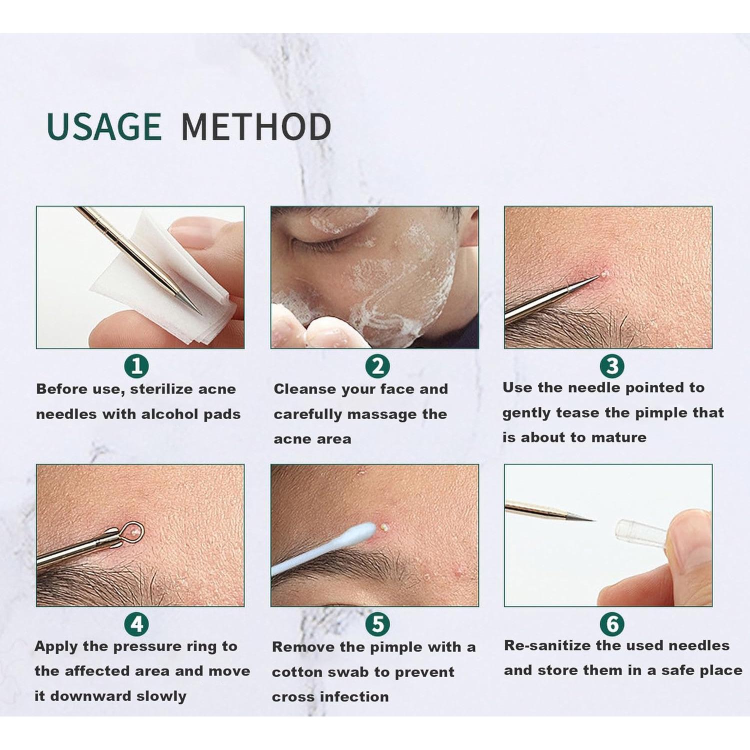 Kit de Extracción de Espinillas HaimiLiya 4 Piezas Oro Rosa