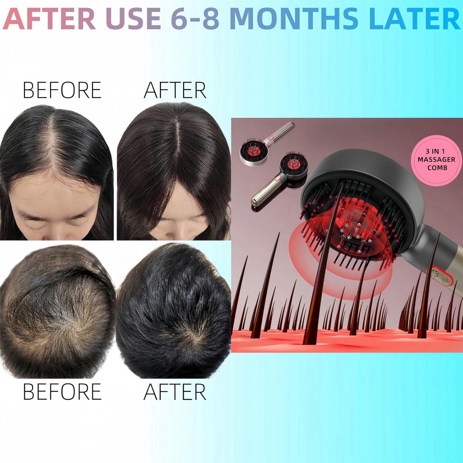 Masajeador de cuero cabelludo YXYOUNG A-803 con luz roja