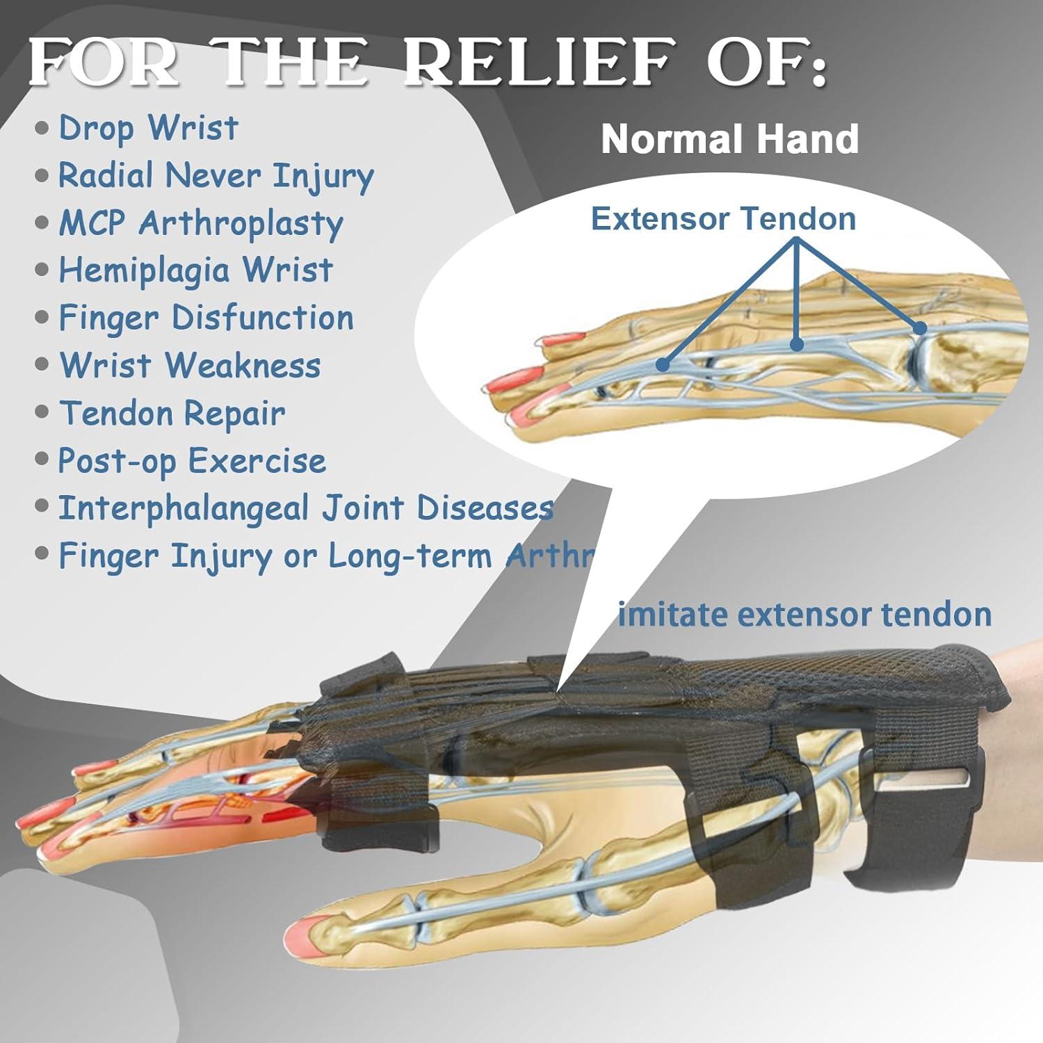 Radial Nerve Palsy Splint, Adjustable Finger Extension Brace, Lift Elastic Splint for Drop Wrist, Radial Nerve Injury, Mcp Arthroplasty, Crutch Palsy Treatment, Fit Left & Right Hand