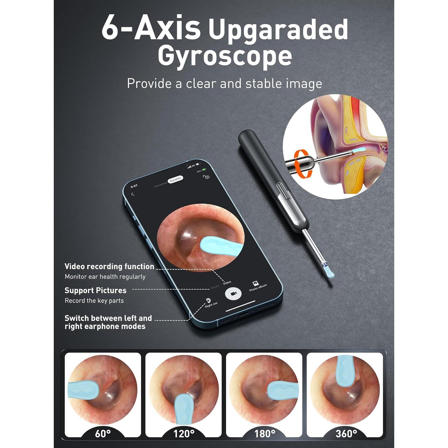 Limpiador de Oídos Inalámbrico Yorsfun N5 HD 1080P 7 Piezas