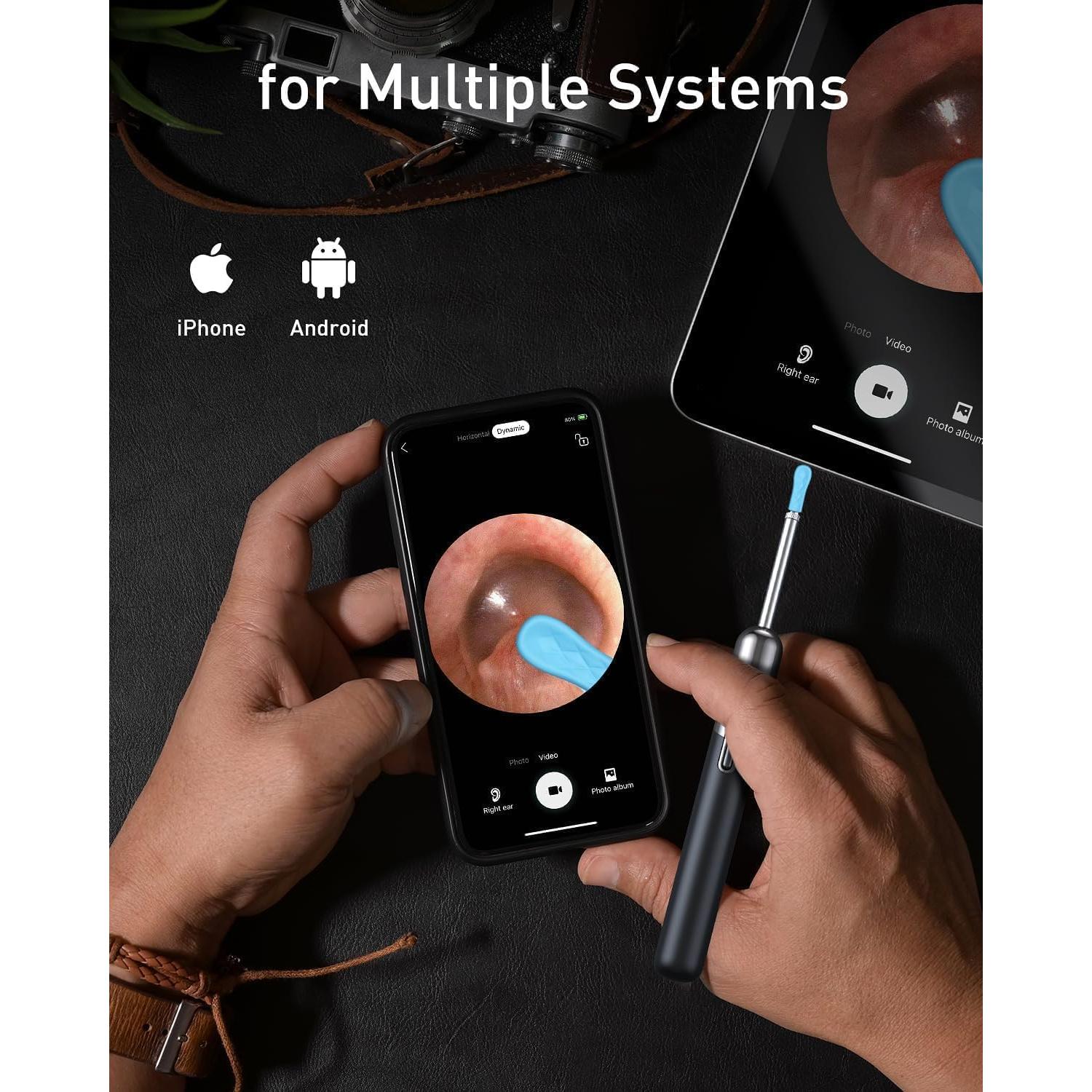 Limpiador de Oídos Inalámbrico Yorsfun N5 HD 1080P 7 Piezas
