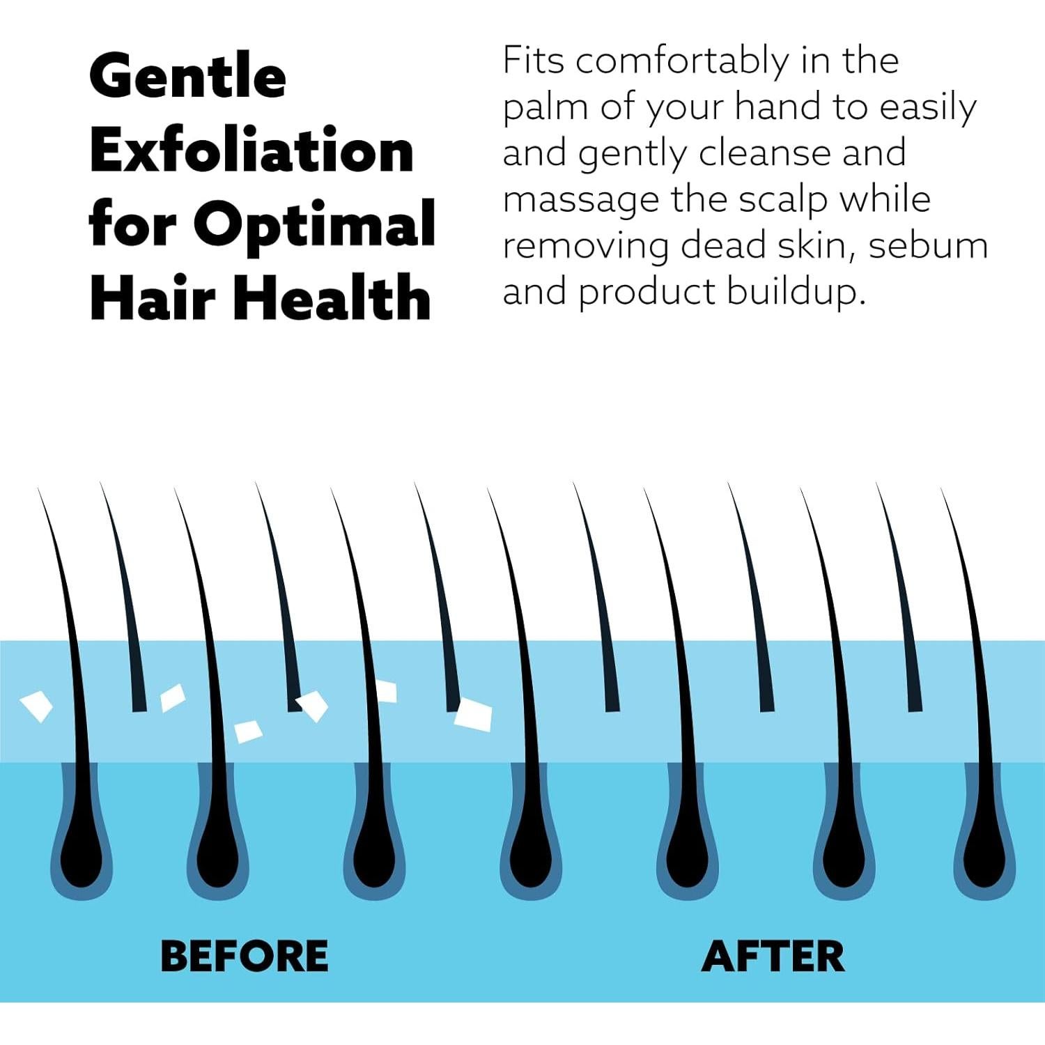 Masajeador Exfoliante Wet Brush Coral para Cuero Cabelludo