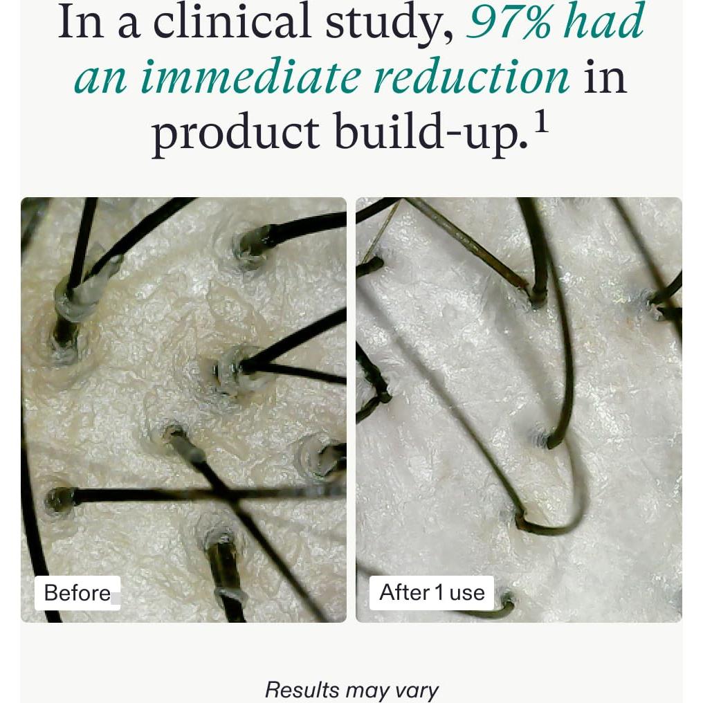 Mascarilla Exfoliante Nutrafol 113g para Cuero Cabelludo