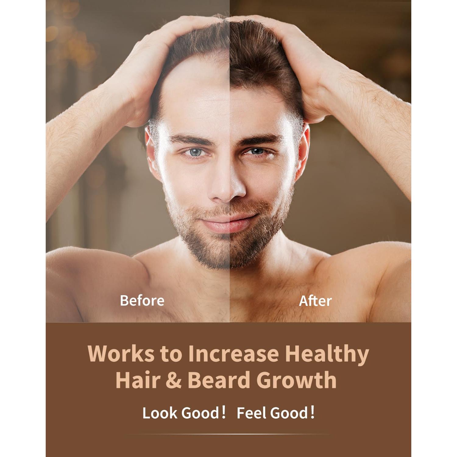 Set de Suero y Aceite Capilar VEDA TINDA para Crecimiento