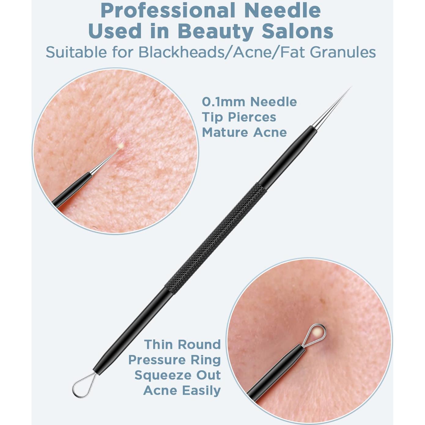 Kit Removedor de Puntos Negros TAYTHI - 5 Herramientas Acero Inoxidable