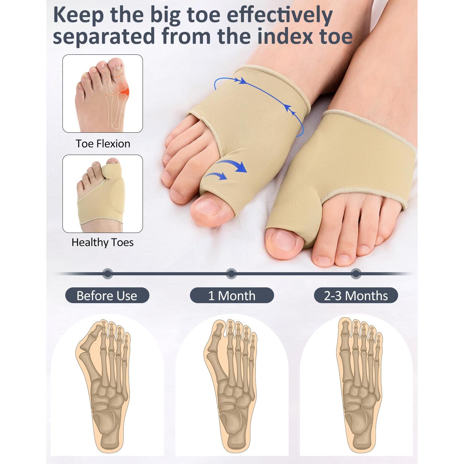 2 Pcs Bunion Corrector for Women Men Bunion Pain Relief, Big Toe Straighteners, Breathable Bunion Correction Socks with Built-in Gel Pad, Big Toe Spacer Separators (Beige)