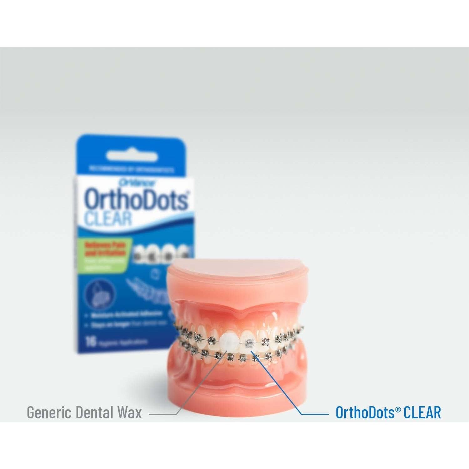 OrthoDots CLEAR Orvance 12 Unidades Alivio para Frenos