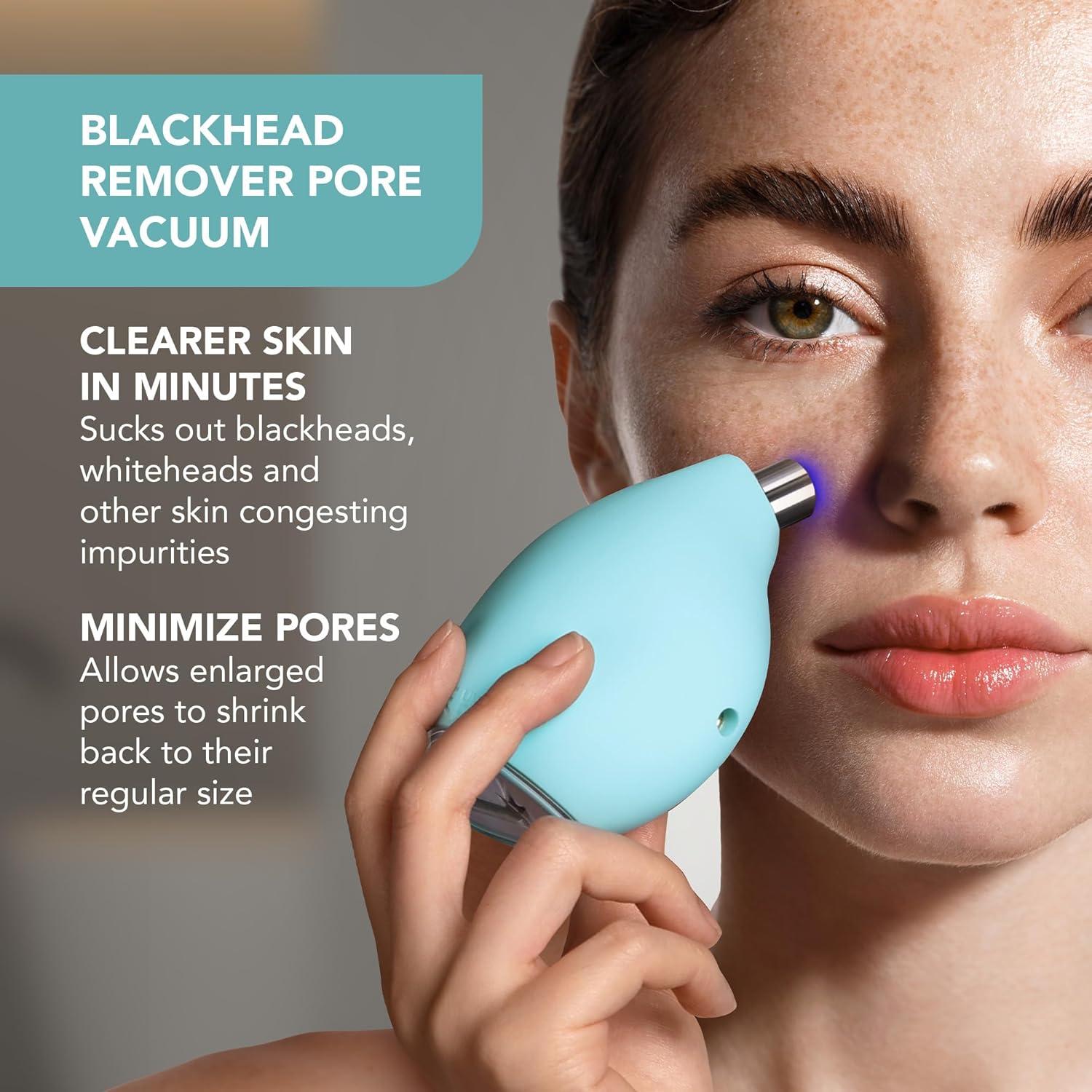 Extractor de Puntos Negros FOREO KIWI - Succión Potente y Higiénico