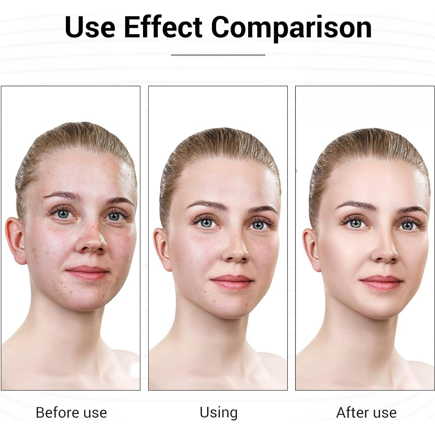 Máscara Facial LED Terapia 7 Colores Banniver Recargable