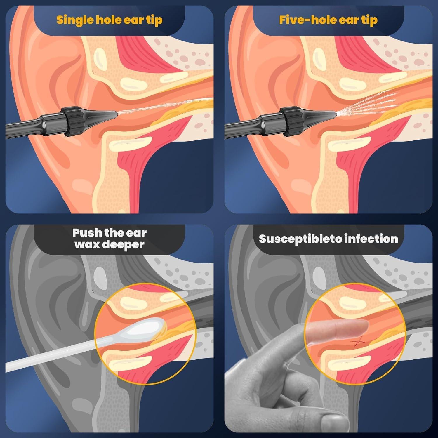 Limpiador de Oídos Eléctrico WEUANY W602 - Kit de Irrigación con 4 Modos