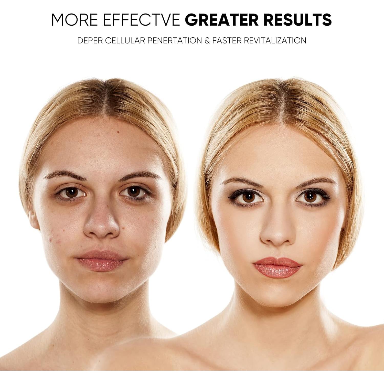 Máscara Facial LED GOHIGK RH-01 Terapia de Luz 3 Colores