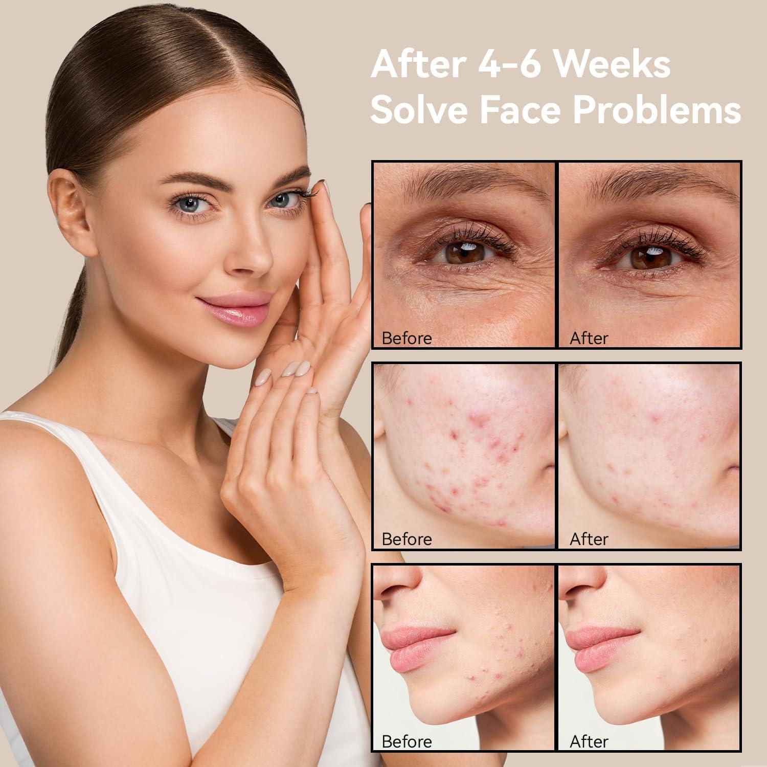 Máscara Facial LED MEGELIN 7 Colores Terapia Luz Rejuvenecedora