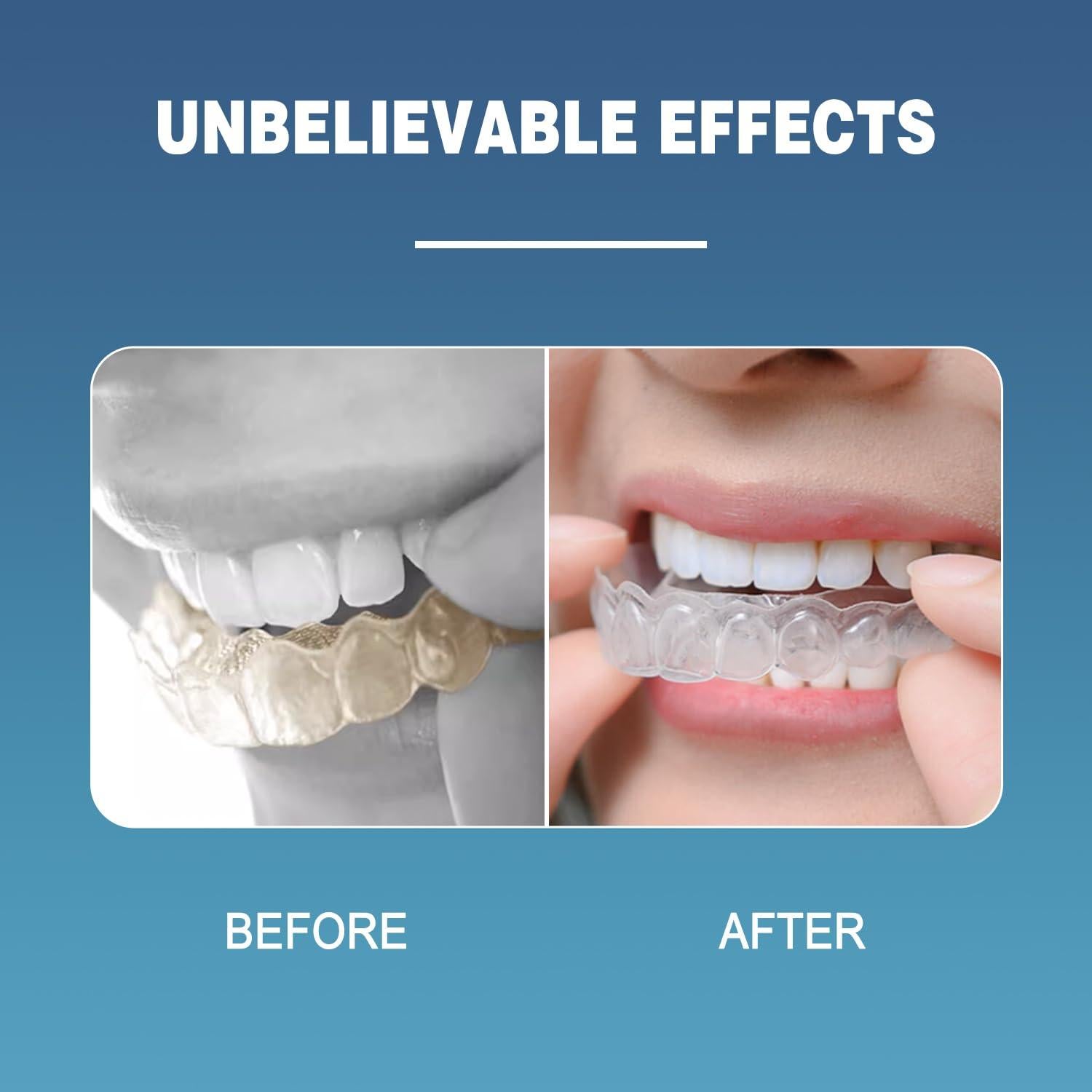 Tabletas Limpiadoras EZGO SUVELAM para Dentaduras 120 pcs