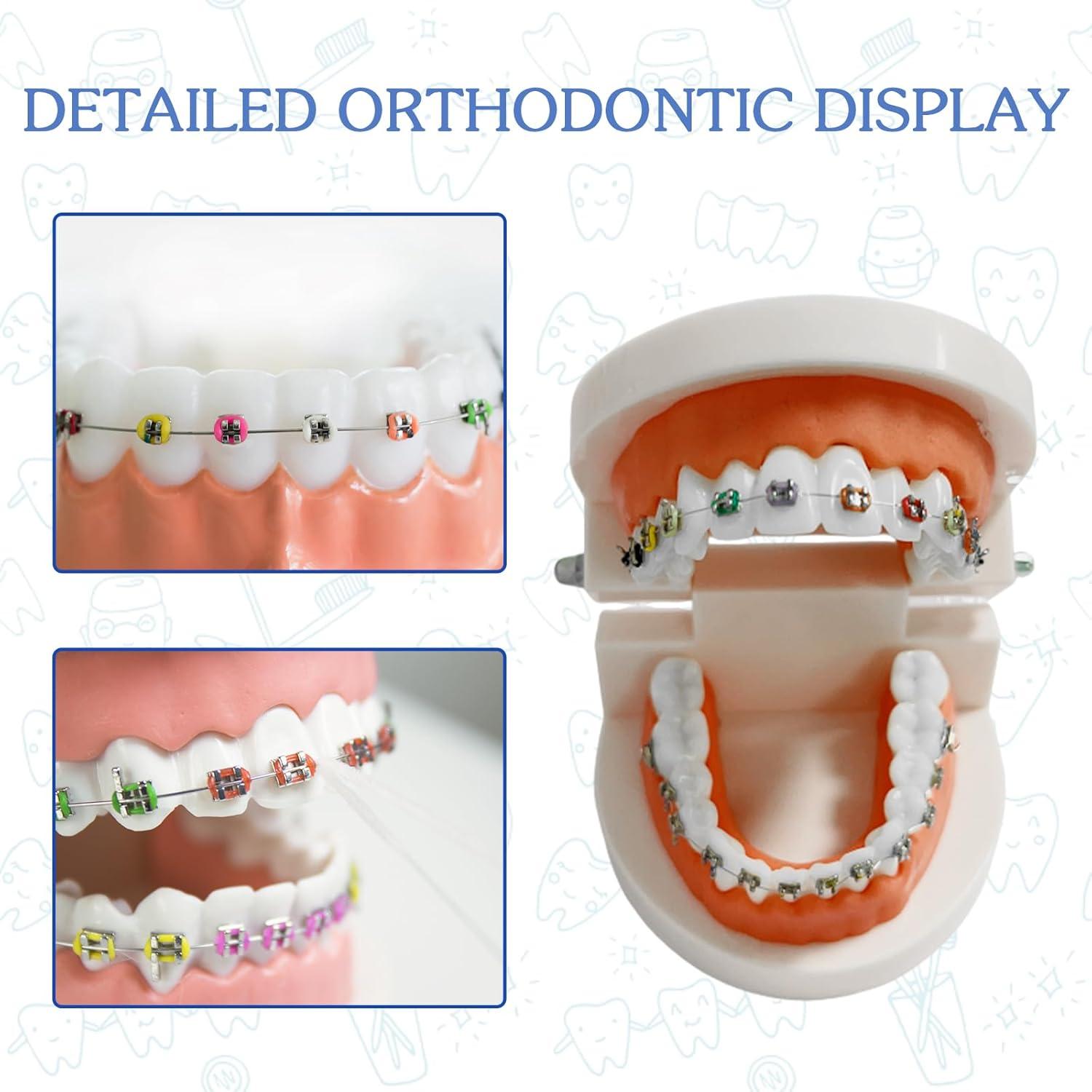 Modelo Dental Ortodontico Ceonam JY+YT con Brackets Coloridos